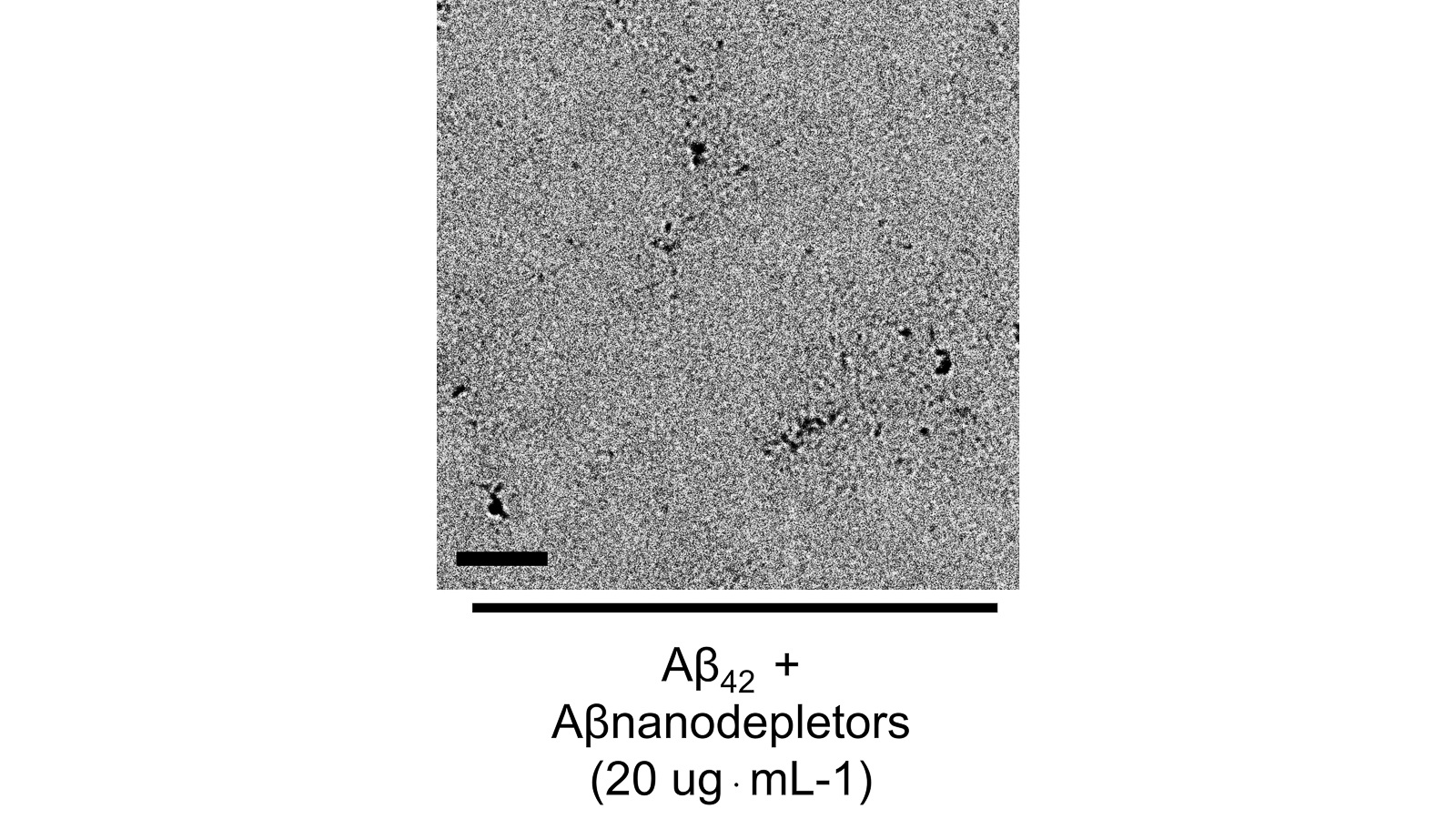 Transmission Electron Microscopy (TEM) images of Aβ peptide samples in the presence of the Aβ nanodevices (scale bar: 200 nm). The lack of grains in the image indicates the effectiveness of the nanodevice in trapping the peptides. (Image by Argonne’s Center for Nanoscale Materials.)
