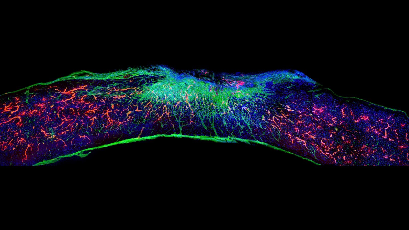 Blood vessels (red) regrow inside a damaged spinal cord after treatment with ‘dancing molecules. (Image by Samuel I. Stupp Laboratory/Northwestern University.)